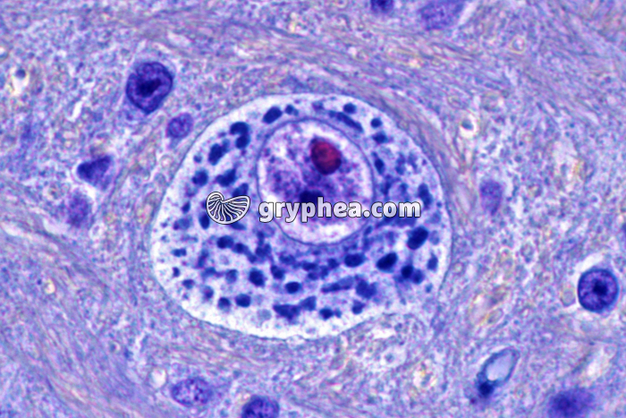 Neurone en CT avec corps de Nissl x400 - gryphea.com